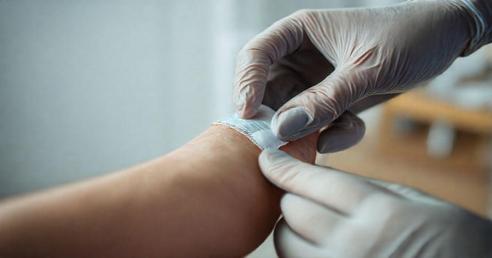 Curativo Especial para Feridas: Cuidados e Benefícios Curativo Especial para Feridas: Cuidados e Benefícios