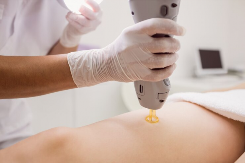 Laserterapia Sistêmica: Benefícios Incríveis para Sua Saúde Laserterapia Sistêmica: Benefícios Incríveis para Sua Saúde