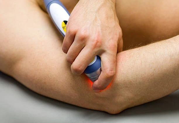 Laserterapia preço